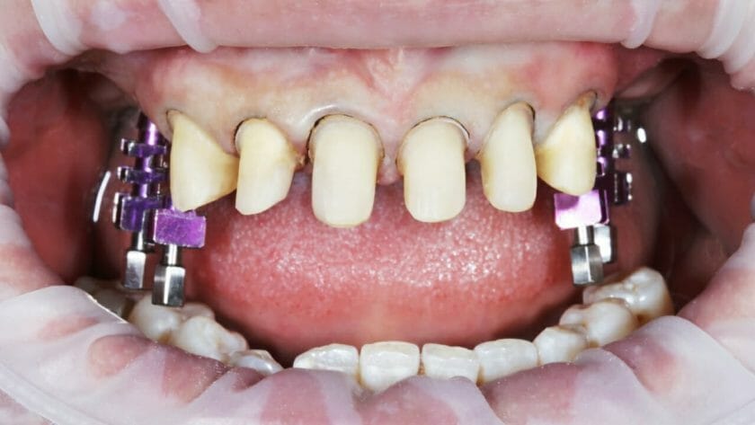 teeth s2261832907